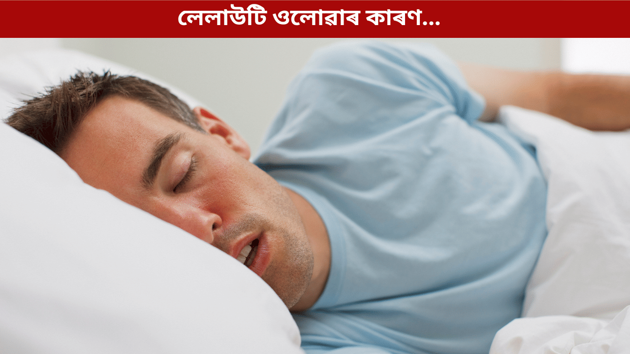 নিশা শোৱাৰ সময়ত মুখৰ পৰা লেলাউটি ওলাই নেকি? জানক ইয়াৰ কাৰণ, প্ৰতিকাৰৰ উপায়... নিশা শোৱাৰ সময়ত মুখৰ পৰা লেলাউটি ওলাই নেকি? জানক ইয়াৰ কাৰণ, প্ৰতিকাৰৰ উপায়...