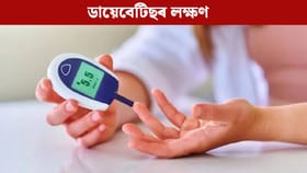Blood Suger: ব্লাড চুগাৰ বৃদ্ধিৰ এইসমূহ লক্ষণক নকৰিব আওকাণ, পৰিব ডাঙৰ বিপদত…...