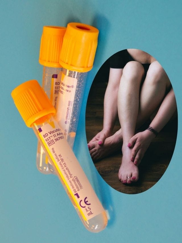 দেহত দেখিছে নেকি এনে লক্ষণ? সাৱধান, নীৰৱে বাঢ়িব পাৰে ইউৰিক এচিড