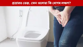 প্ৰস্ৰাৱৰ দুৰ্গন্ধ, তেজ, ফেন… এয়া কি ৰোগৰ লক্ষণ? জানক...