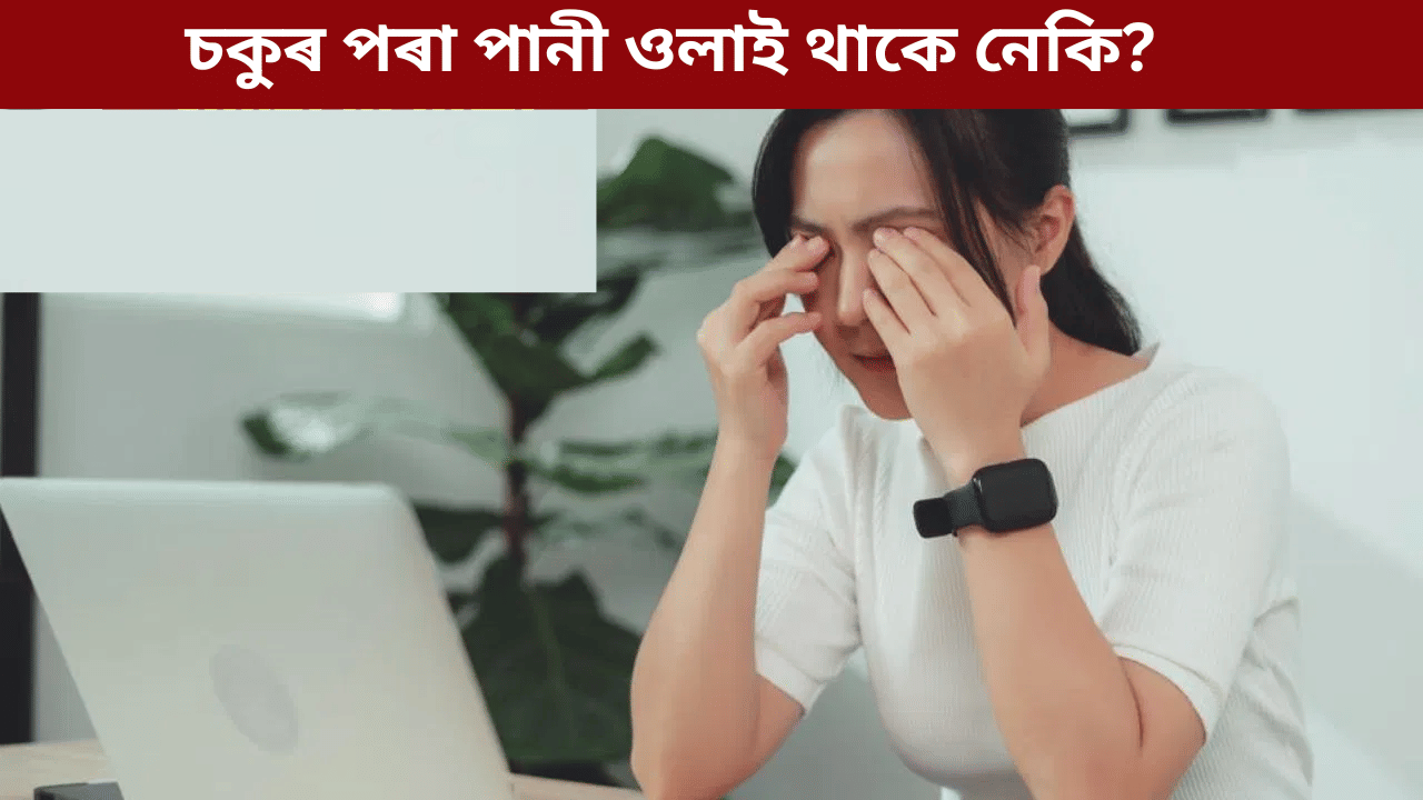 চকুৰ পৰা বাৰে বাৰে পানী ওলাই নেকি? ই কি ৰোগৰ লক্ষণ, জানক... চকুৰ পৰা বাৰে বাৰে পানী ওলাই নেকি? ই কি ৰোগৰ লক্ষণ, জানক...